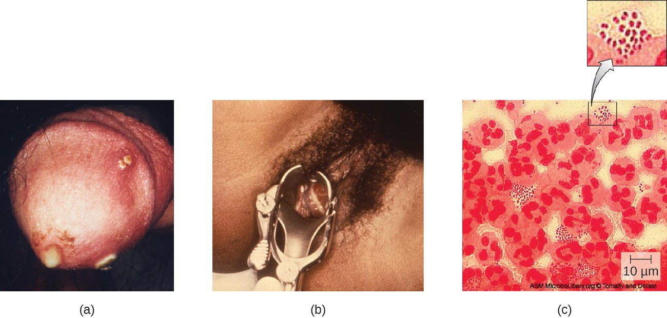 Fig.-23.10