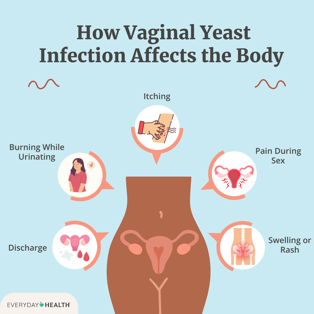 eh-how-vaginal-yeast-infection-affects-the-body-seo-graphic_lauren